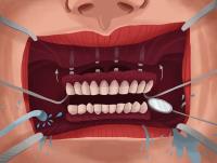 Dentist Hillcrest - Heathwood Smiles Dental image 2